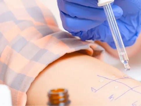 Allergy Skin Testing Jacksonville Beach FL