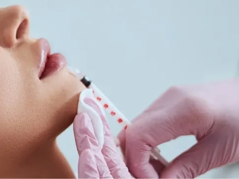 female patient receiving needle injection in bottom lip from professional in pink glove