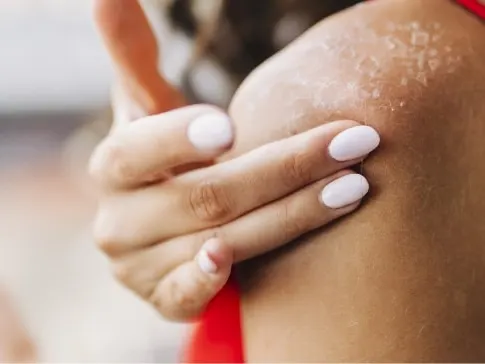 Sun Damage Treatment Jacksonville Beach FL