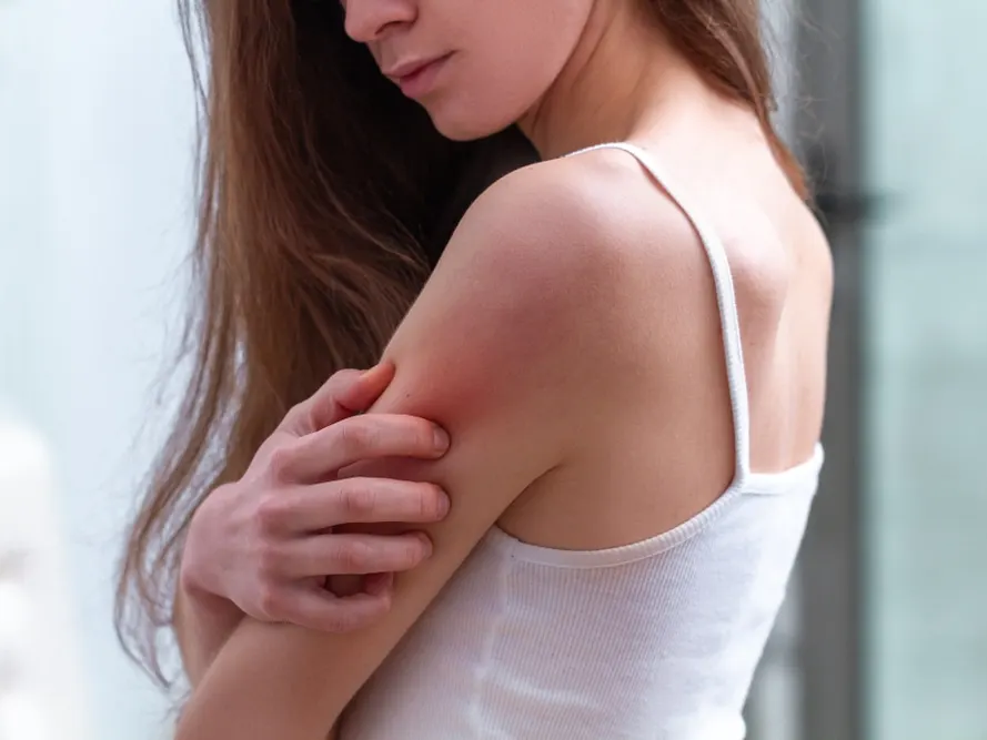 Woman scratching a red, irritated area on her upper arm