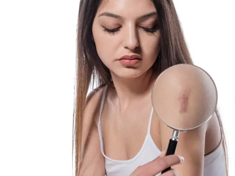woman holding magnifying glass and showing surgery scar.
