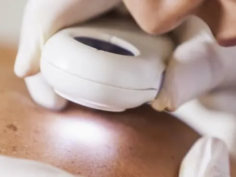 MOHS Surgery Jacksonville Beach FL