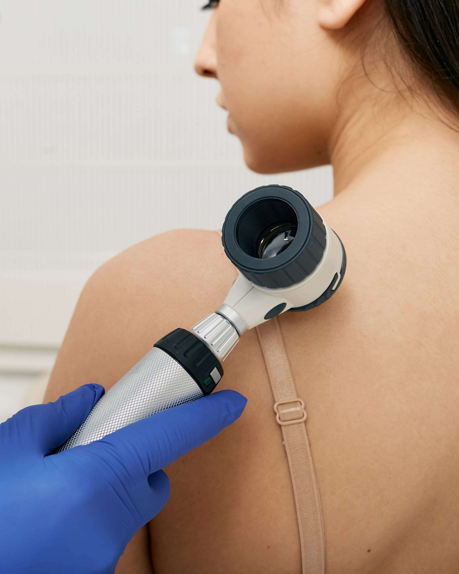 A gloved clinician checking the skin of a patient's shoulder with a dermatoscope — a stock picture