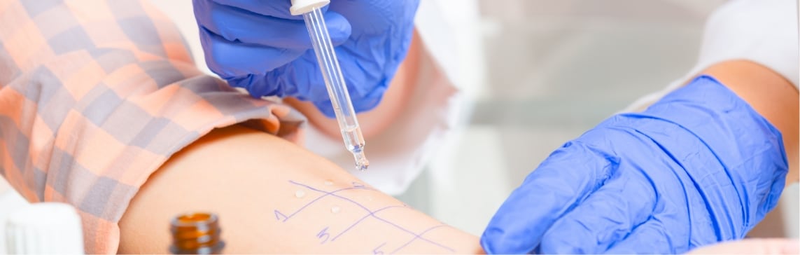 Allergy Skin Testing Jacksonville Beach FL
