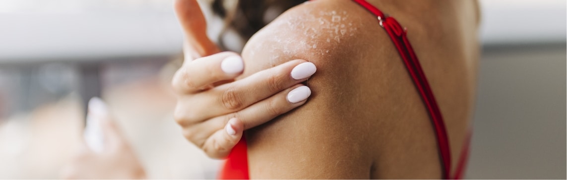 Sun Damage Treatment Jacksonville Beach FL