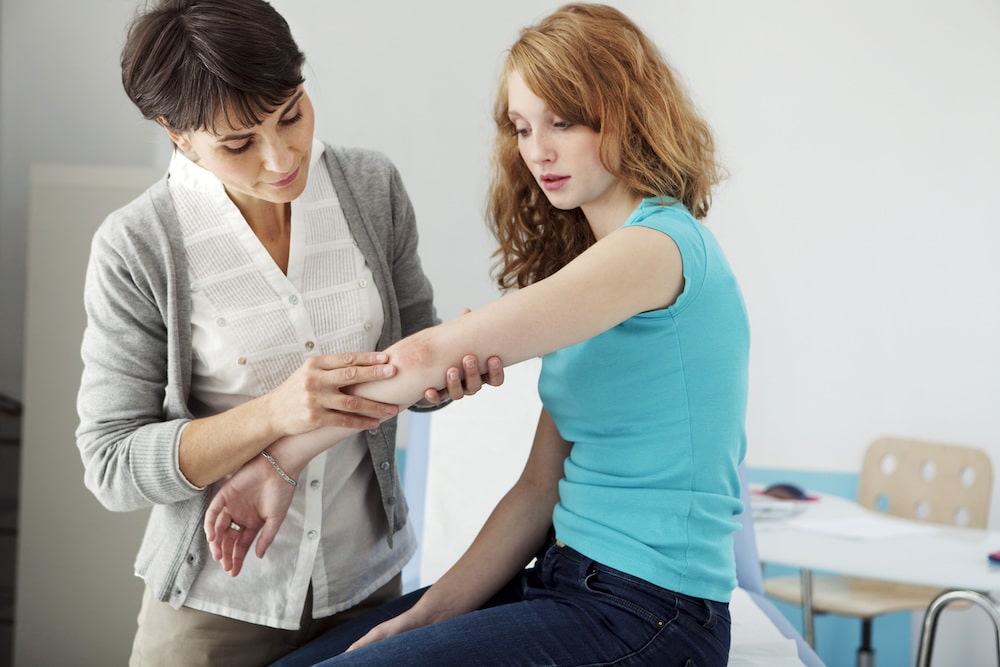 Dermatology consultation for psoriasis