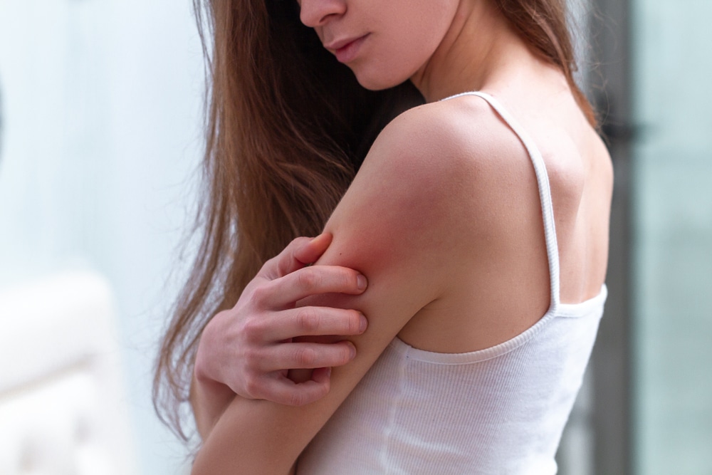 Woman scratching a red, irritated area on her upper arm