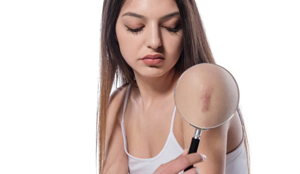 woman holding magnifying glass and showing surgery scar.