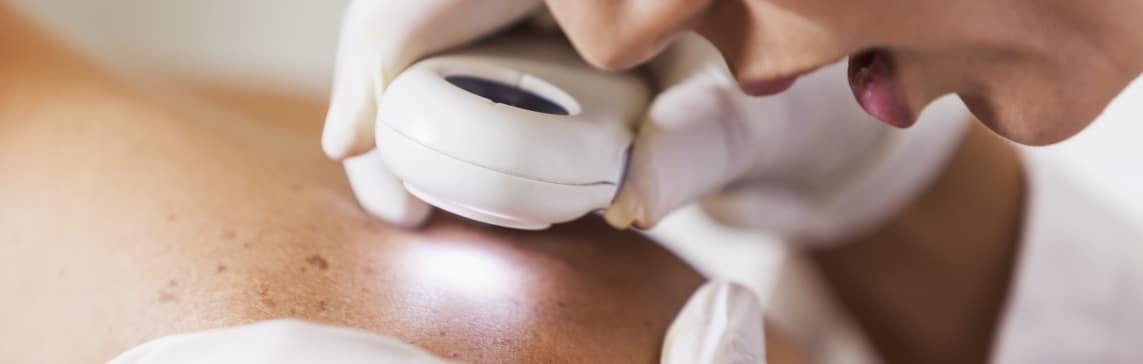MOHS Surgery Jacksonville Beach FL