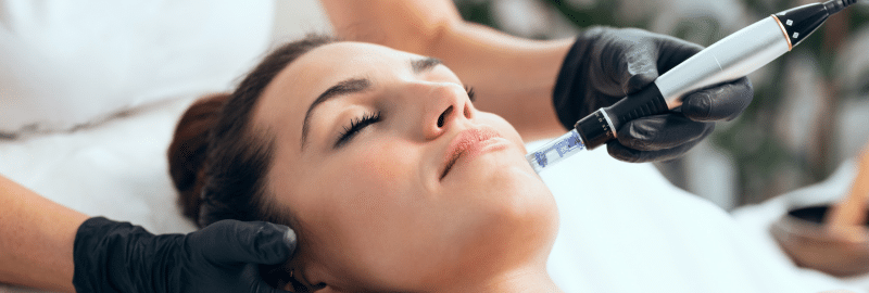 Microneedling in Jacksonville Beach