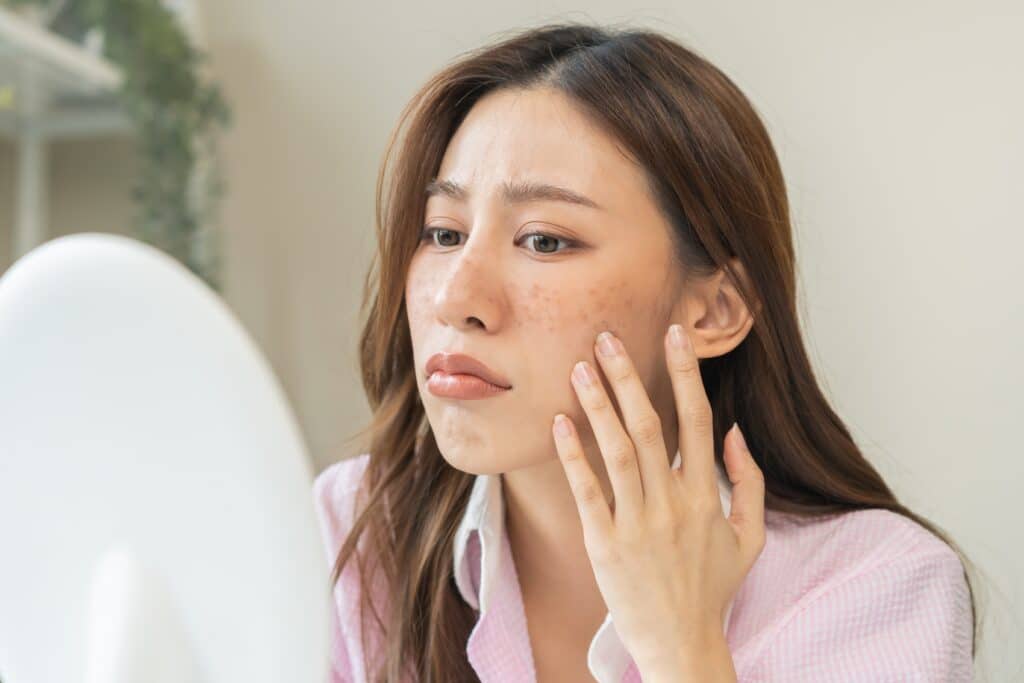 A woman looking in the mirror for signs of skin damage