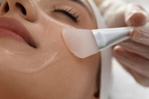 Woman getting chemical peel applied to face